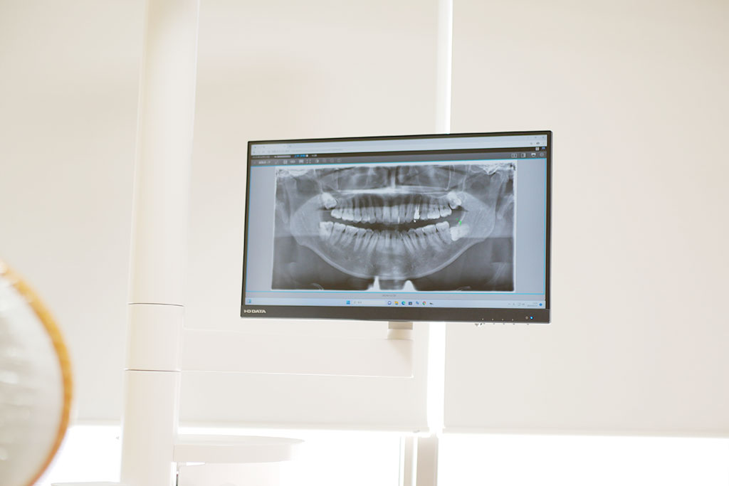 説明用モニター