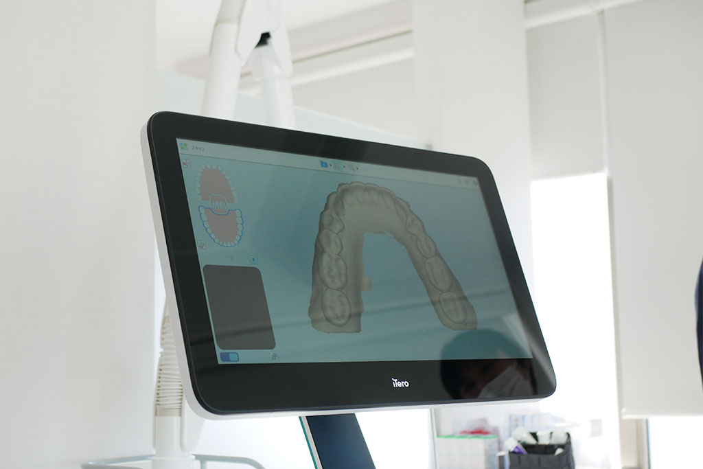 口腔内3Dスキャナー